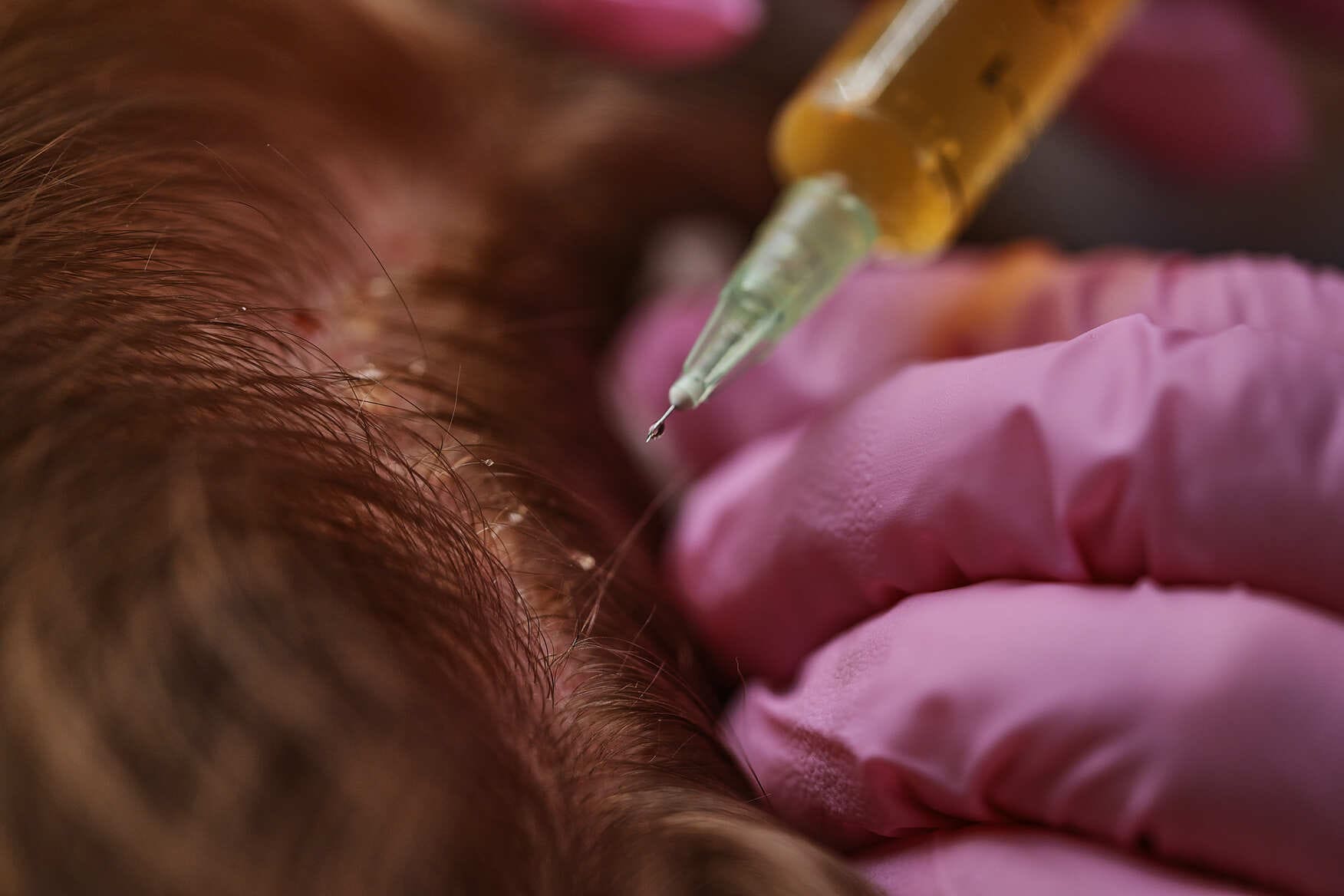 How Meso Therapy for Hair Works