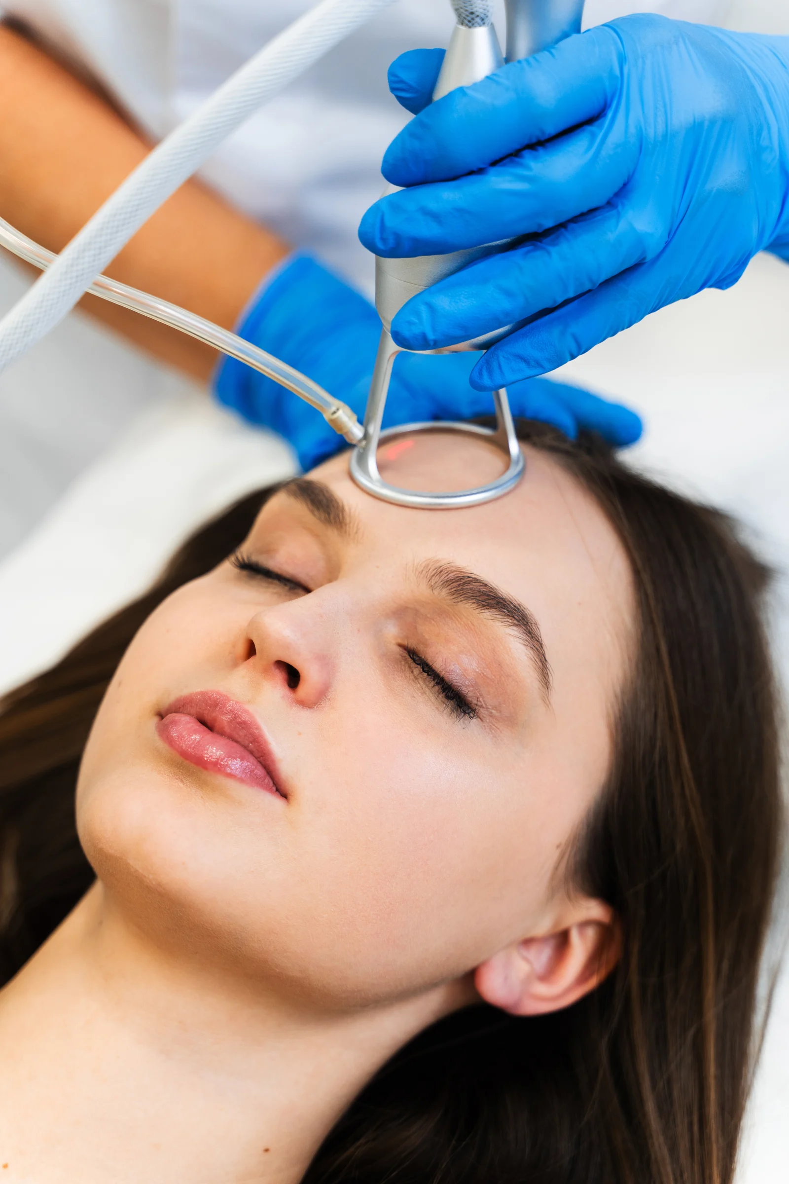 Advanced Acne Treatment for Pimples, Marks & Oil Control